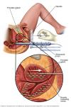Photo for Brachytherapy Market Study By Technique, Application & Top Key Players - Boston Scientific Corporation, C. R. Bard, Inc., C4 Imaging, L.L.C., Cianna Medical, Inc.