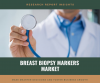 Photo for Breast Biopsy Markers   Market research Share to Witness Steady Rise in the Coming Decade