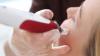 Photo for Microneedling Devices Market Size, Share, Outlook, and Analysis, 2018-2026