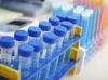 Photo for Insomnia Therapeutics Market To, 2025 Trends, Growth and Key Players - Ebb Therapeutics., Merck & Co., Mylan N.V., Paratek Pharmaceuticals, Inc., Pfizer Inc., Sanofi S.A.