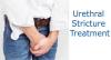Photo for Urethral Stricture Treatment Market —Size, Trends, Outlook, and Opportunity Analysis, 2018 – 2026
