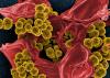 Photo for Methicillin-Resistant Staphylococcus Aureus (MRSA) Drugs Market Set for Rapid Growth And Trend by 2026