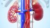 Photo for Kidney Transplant Doctors Delhi, India