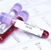 Photo for CA 125 Test Market Study By Devices, Indication & Top Key Players - AbbVie Inc., Allergan plc, AMAG Pharmaceuticals, Amgen Inc., Bayer, Becton Dickinson, Eli Lilly Company