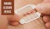 Photo for Wound Closure Device Market Size, Segment Analysis and Growth Drivers to 2024