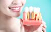Photo for Dentist Implants USA