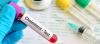 Photo for Cholesterol Testing Services Market Trends Research And Projections For 2018-2026
