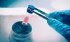 Photo for Stem Cell Banking Market To Receive Overwhelming Hike In Revenues By 2026