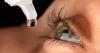 Photo for Viral Conjunctivitis Drugs Market Trends, Outlook and Opportunity Analysis 2018-2026
