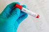 Photo for Cytomegalovirus  Infection Treatment and Diagnosis Market Existing Trade Leaders, Revenue Metrics and Future Roadmap 2026