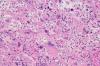 Photo for Tissue Diagnostic Market Enhancement in Medical Sector 2017 to 2026