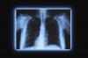 Photo for X-ray Market - Size, Share, Trends and Forecast till 2025