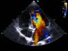 Photo for Echocardiography Market Study By Product Types, Technology & Top Key Players - GE Healthcare, Koninklijke Philips, Siemens Healthcare