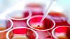 Photo for Research On Multiple Myeloma Therapeutics Market Report By Amgene, Inc., Bristol-Myers Squibb, Bristol-Myers Squibb Company, Celgene Corporation, Genzyme Corporation