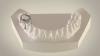 Photo for Dental 3D Printing Devices Market - Global Industry Insights, Trends, Outlook, and Opportunity Analysis, 2018-2026