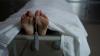 Photo for Postmortem Mesothelioma Diagnosis