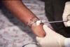 Photo for Leishmaniasis Treatment Market Revenue Growth Predicted by 2026