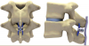 Photo for Interspinous Spacers Market - Trends, Size, Share and Analysis, 2026