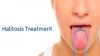 Photo for Halitosis Treatment Market - Size, Share, Trends, and Forecast 2018-2026