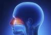 Photo for Global Nasal Drug Delivery Technology Market worth 64.20 Billion USD by 2021 - MarketsandMarkets
