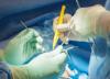 Photo for Electrosurgery Market Study By Type Of Surgery & Top Key Players - Applied Medical Resources Corporation, B. Braun Melsungen AG, Bovie Medical Corporation
