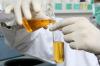 Photo for Fermentation Chemicals Market Report 2018-2025 Product Scope & Key Players - BASF SE, Chr. Hansen A/S, AB Enzymes, DSM, Ajinomoto Company Incorporation