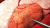 Photo for Solid Tumors Treatment Market - Global Industry Insights, Trends, Outlook, and Opportunity Analysis, 2018–2026