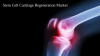 Photo for Stem Cell Cartilage Regeneration Market to Reflect Steady Growth Rate by 2026