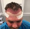 Photo for Dynamic Hair Transplant in Islamabad