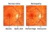 Photo for Retina Specialist