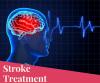 Photo for Global Stroke Treatment Drugs Market 2019 | Manufacturers, Regions, Type And Application, Forecast To 2024