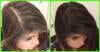 Photo for How Does Work Hair Revival X?