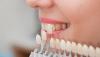 Photo for Cosmetic Dentistry Facility in Las Vegas