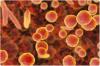Photo for Mycoplasma Diagnostics Market - Global Industry Insights, Trends, and Opportunity Analysis, 2018-2026