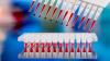 Photo for Molecular Diagnostics Market - Industry Insights, Size, Share and Forecast 2017-2025
