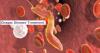 Photo for Chagas Disease Treatment Market - Industry Insights, Trends, Opportunity And Analysis 2025