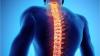 Photo for Global Spinal Trauma Devices Market 2019 | Manufacturers, Regions, Type And Application, Forecast To 2024