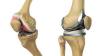 Photo for Global Bone Replacement Products Market - Industry Trends, Analysis And Growth By 2025