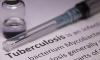 Photo for Tuberculosis Drugs Market Expansion To 2026 Estimated By Global Key Players
