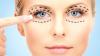 Photo for Blepharoplasty - An Innovative Technique to Rectify Your Eye Defects