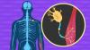 Photo for Global Amyotrophic Lateral Sclerosis (ALS) Treatment Market - Key Companies Profile, Supply and Growth Factors