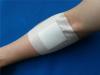 Photo for Global Wound Dressing Market: Incur Rapid Extension During 2016 – 2024