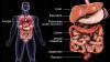Photo for Carcinoid Syndrome Diarrhea Treatment Market Trends And Growth