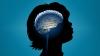 Photo for Autism Spectrum Disorder Therapeutics Market - Size, Share, Outlook,