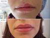 Photo for The Best Semi Permanent Makeup in Tredegarville