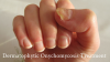 Photo for Dermatophytic Onychomycosis Treatment Market Growth Rate Analysis 2026