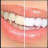 Photo for Dental Crowns Encino