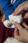 Photo for Bioactive Wound Care Market Size, Share, Growth and Trend Analysis Report to 2024