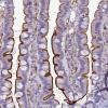 Photo for ace antibody