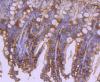 Photo for apaf 1 antibody